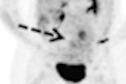 2011 07 01 14 43 34 514 Fdg Pet Fetus Thumb