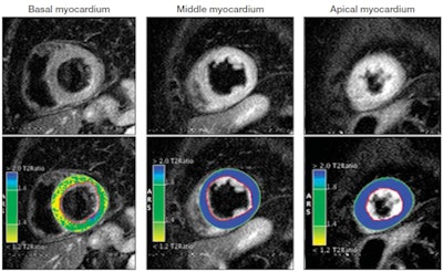 2011 07 18 15 47 39 336 Mr Cardiomyo Fig3 450