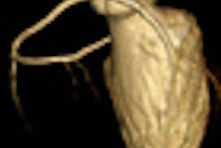 2011 07 18 17 14 46 271 Han Thumb 2011 Comp