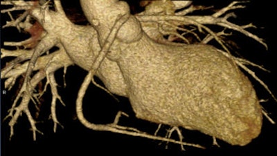 2011 07 18 17 14 51 392 Han high pitch 17yo