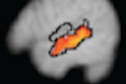2011 07 25 16 03 28 760 Autism F Mri Rad Lai 70
