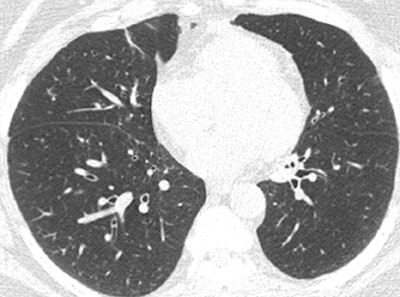 2011 07 29 12 33 28 214 Hand right bottom