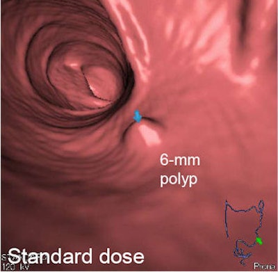2011 07 28 13 30 27 30 Nappi lowdose effect top 394