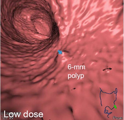 2011 07 28 13 30 30 221 Nappi lowdose effect bottom