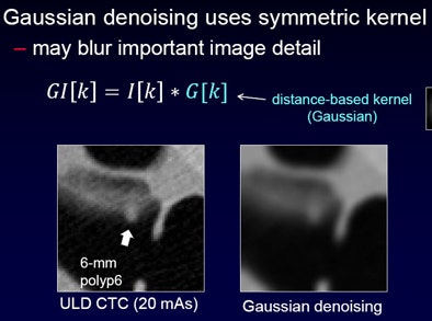 2011 07 28 13 30 31 172 Nappi gaussian denoising top
