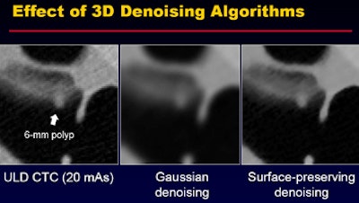 2011 07 28 13 30 33 122 Nappi effect 3ddenoising