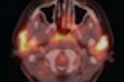 2011 08 05 14 30 35 832 Fdg Pet Ct Hiv Images Ajr Thumb