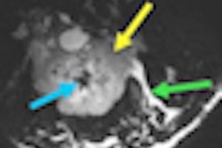2011 08 09 11 56 38 249 Stanford Breast Coil Image 02 Thumb