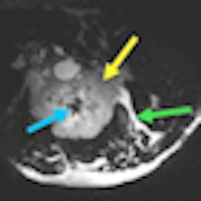 2011 08 09 11 56 38 249 Stanford Breast Coil Image 02 Thumb
