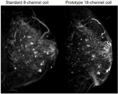 Standard versus prototype coil