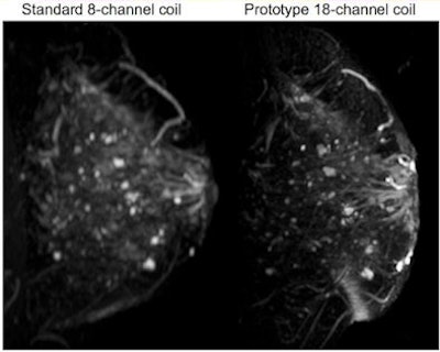 Standard versus prototype coil