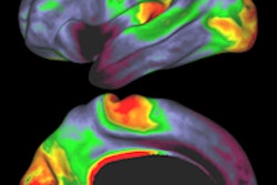 2011 08 09 15 01 54 588 Myelin Map Nb 2011 08 10 Mr Imyelin 200