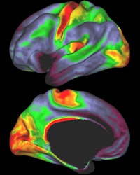 Red and yellow indicate regions with high myelin levels, while blue, purple, and black areas have low myelin levels. Image courtesy of David Van Essen, PhD.