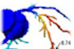 2011 08 12 13 29 44 301 Min thumb 08 70x70