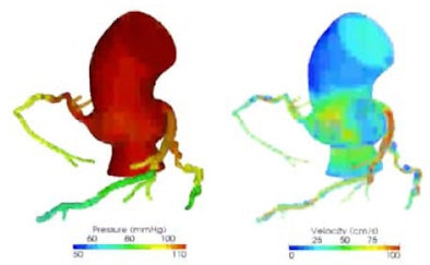 2011 08 12 13 29 57 474 Min ffr from Ccta 394