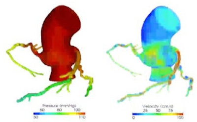 2011 08 12 13 29 57 474 Min ffr from Ccta 394