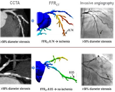 2011 08 12 13 39 47 413 Min ffr Examples 394 V2