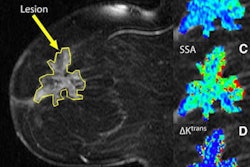 2011 08 24 15 39 30 522 2011 08 25 Shutter Speed Breast Mri