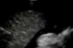 2011 08 31 15 44 59 491 2011 09 01 Shokoohi Thumb