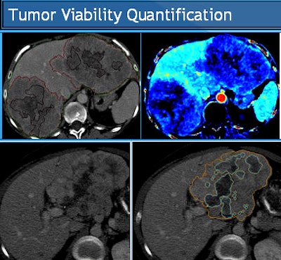 2011 09 14 13 50 53 773 Sahani Tumor Viability