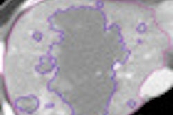 2011 09 14 13 50 56 358 Sahani Thumb 09 11 70x70