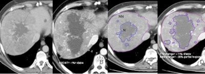 2011 09 14 13 51 02 196 Sahani 52 Yearold Response