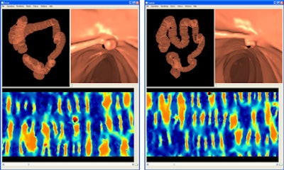 2011 09 14 15 20 21 652 Roth image2