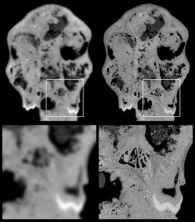 A comparison of the juvenile skull imaged with medical CT (left) versus synchrotron scanning (right). Voxel size is approximately 450 µm for the medical CT scan, compared with 45.71 µm with synchrotron imaging. Image courtesy of ESRF and Paul Tafforeau, PhD.