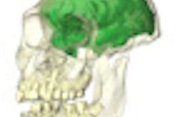 2011 09 22 15 49 37 573 2011 09 23 Brain Endocast Thumb