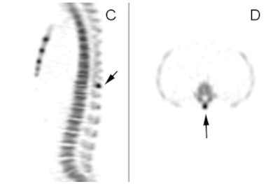 2011 09 27 13 40 30 48 Druback Figure2 394 Bottom