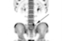 2011 09 27 13 46 49 239 Druback Figure1 Thumb