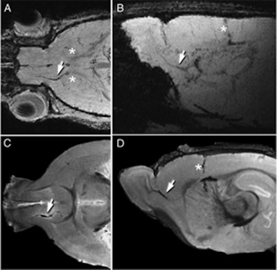 MRI helps follow the migration of neuroblasts tagged with ferritin-based reporter