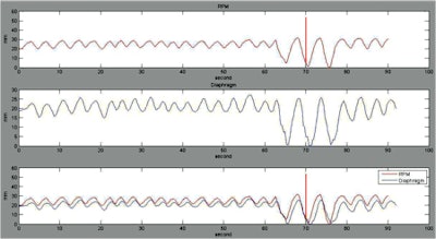 Comparison between the RPM signal and the diaphragm motion.