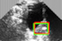 2011 09 30 13 46 07 452 Us Schlosser2 Thumb