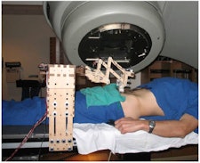 The robotic manipulator controls the pressure and position of an ultrasound transducer. The linac head can be seen behind the robotic arm.