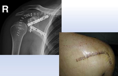 2011 10 11 14 46 41 344 Sosna orthopedic bottom