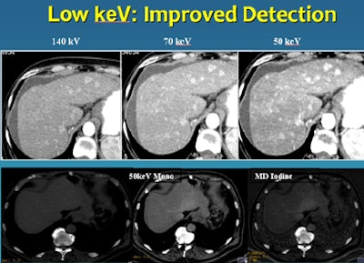 These low-kV images can be produced while keeping the 120-kV image for comparison purposes