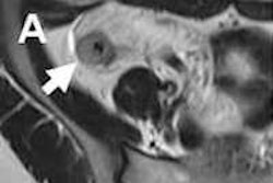 2011 10 18 13 59 38 586 Enterography Fig4 Crop 200