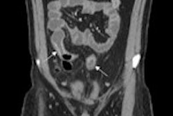 2011 10 18 14 22 06 746 Enterography Fig1 Crop 150