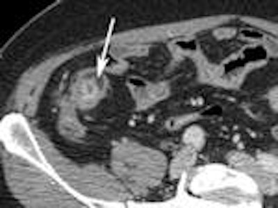 2011 10 21 16 33 48 275 Enterography J 150