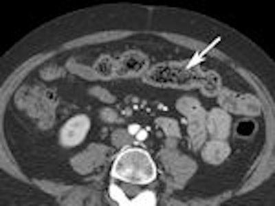 2011 10 21 16 33 50 613 Enterography I 150