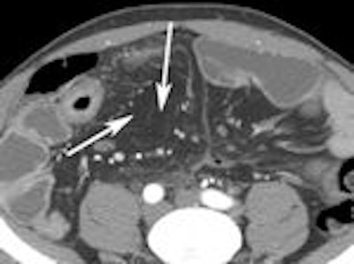 2011 10 21 16 33 51 355 Enterography G 150