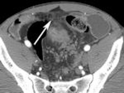 2011 10 21 16 33 55 506 Enterography E 150