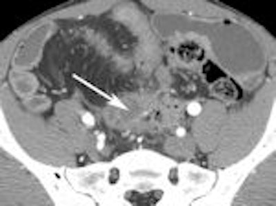 2011 10 21 16 33 56 126 Enterography D 150