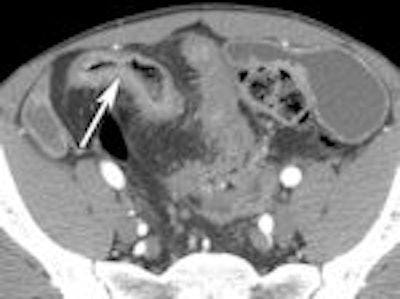 2011 10 21 16 33 57 444 Enterography C 150