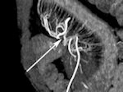 2011 10 21 16 33 58 618 Enterography B 150