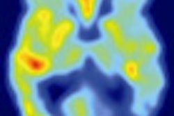 2011 11 16 15 55 35 454 Figure01 Alzheimer 70