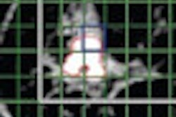 2011 11 21 15 51 51 851 Rad Mr Spectroscopy Breast Thumb