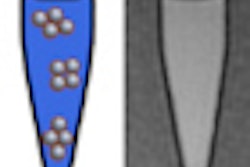 2011 11 23 12 58 06 797 Faucher Nanoparticles Mri Thumb