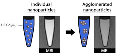 The Study Establishes The Potential Of The Ultrasmall Nanoparticles As A Positive Contrast Agent For Mri